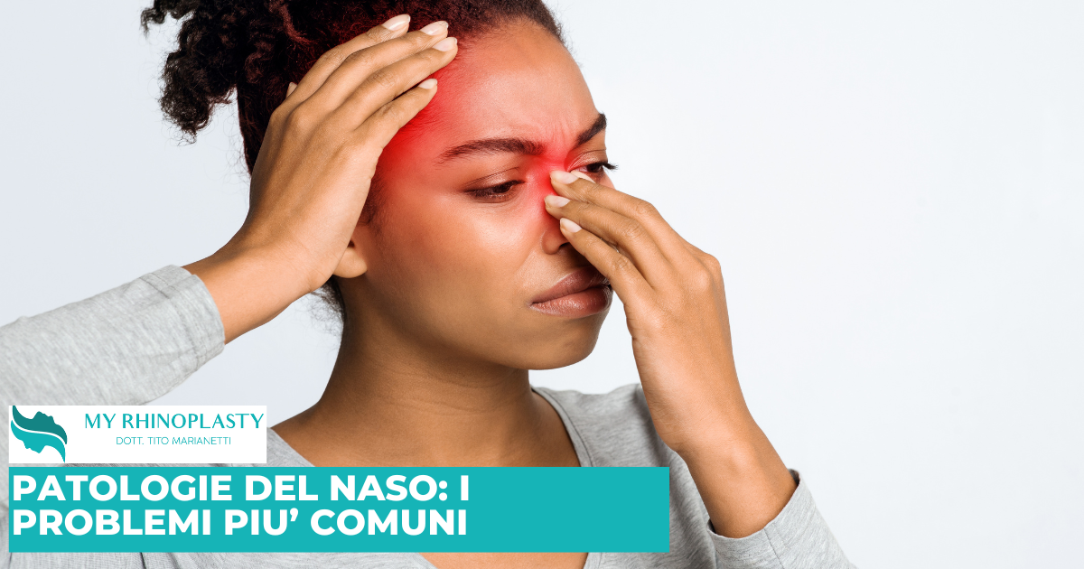 Patologie del naso: i 10 problemi più comuni