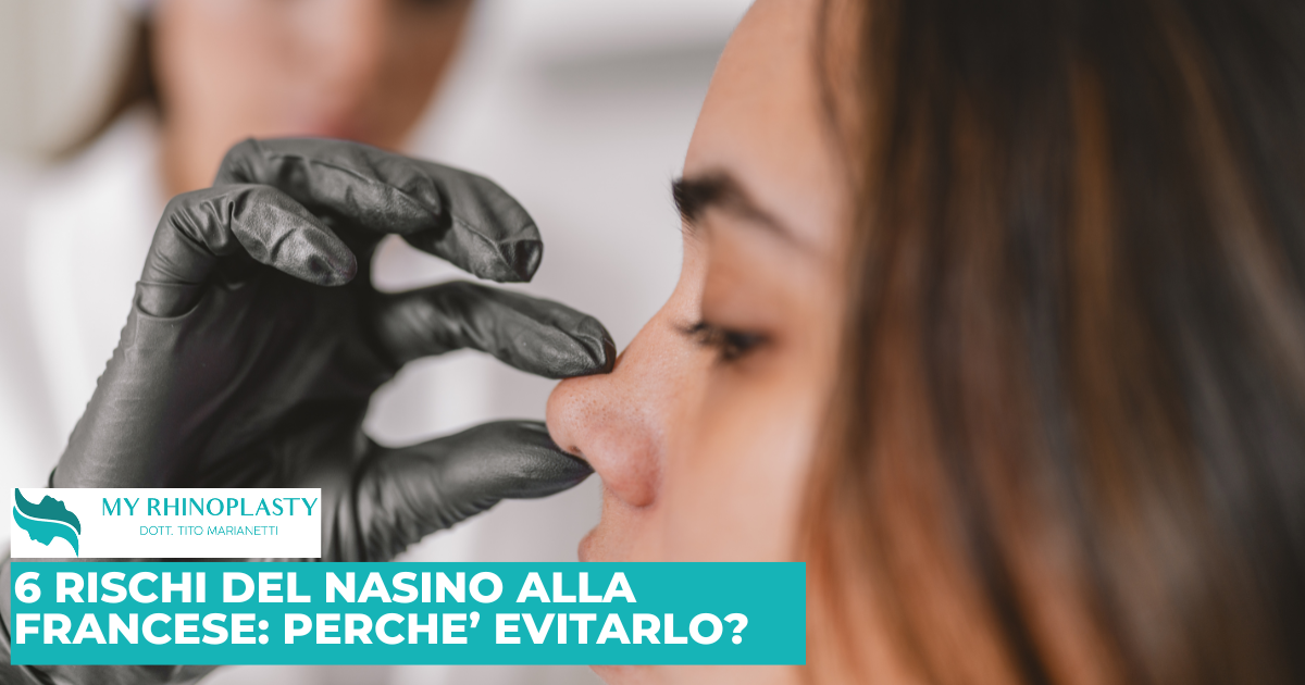 6 Rischi del Nasino alla Francese: perché evitarlo.