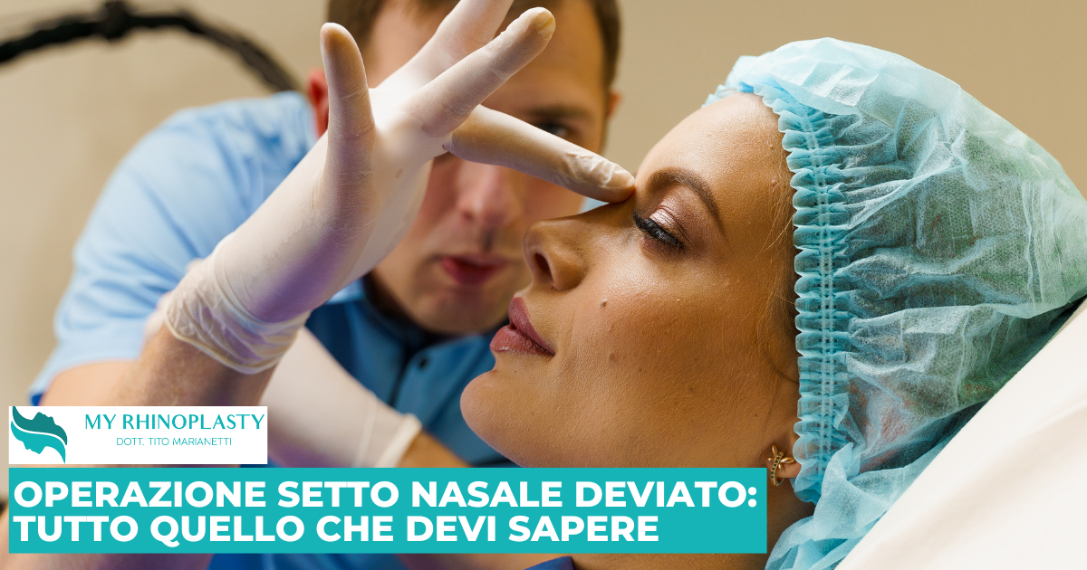 Operazione Setto Nasale Deviato: Tutto Quello che Devi Sapere