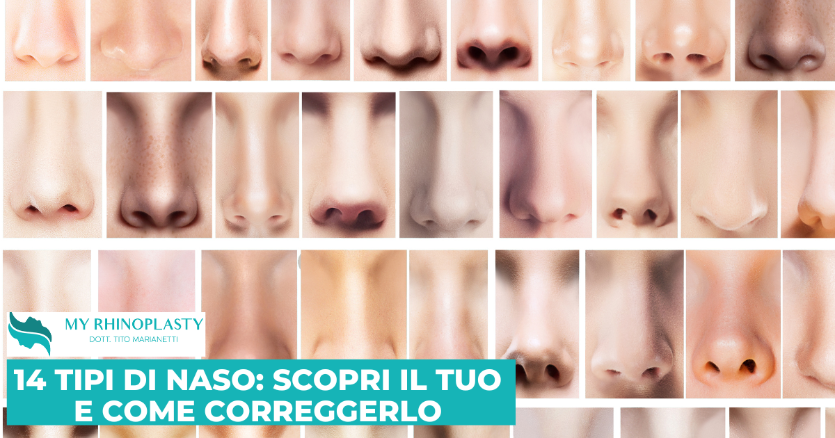 14 tipi di naso: scopri il tuo e come correggerlo